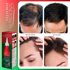 1+1 Velform Nutritional Lotion pour la pousse des cheveux 2x200ml
