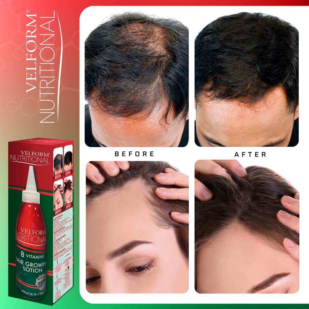 1+1 Velform Nutritional Lotion pour la pousse des cheveux 2x200ml