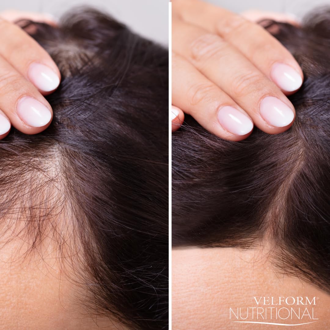 1+1 Velform Nutritional Lotion pour la pousse des cheveux 2x200ml