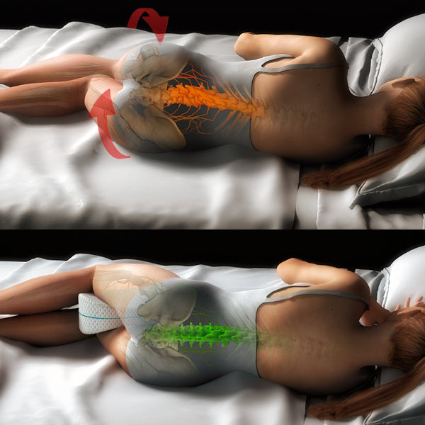Bessere Schlafposition dank Beinkissen