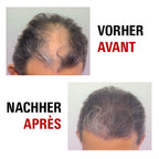Power Grow Max - Système pour une nouvelle croissance de cheveux