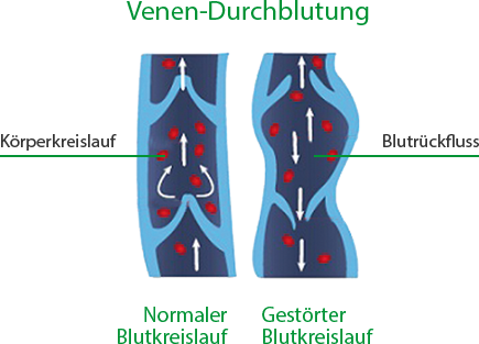 Drainastim Pro