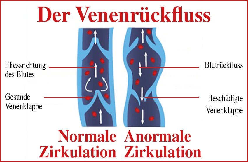 Drainastim XT