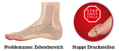 Druckstellen