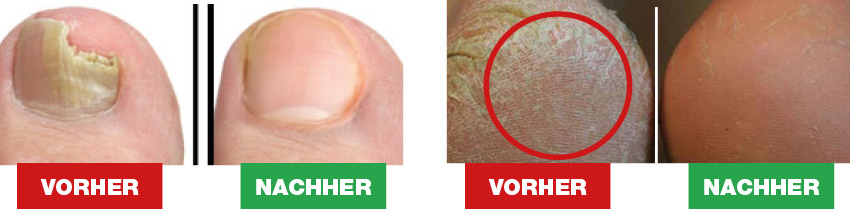 FOOT CARE