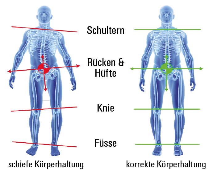 superthotic