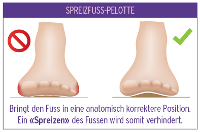 Spreizfuss
