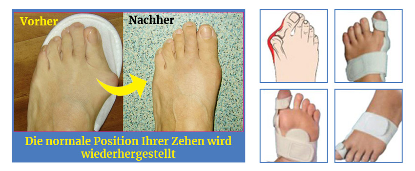 Valgus Medic